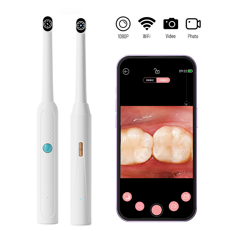 Endoscopio Orale WiFi Wireless - Lighting Visual recensione e prezzo