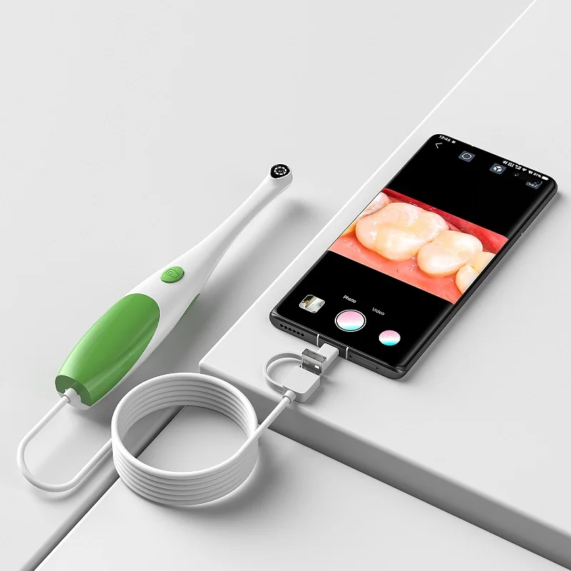 Endoscopio Orale con Telecamer - Lighting Visual recensione e prezzo
